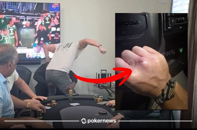 Poker Pro Who Beat Up Maurice Hawkins Says Guns Involved